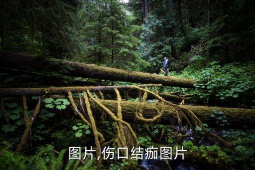 结痂图片,伤口结痂图片